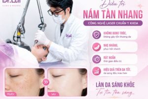 Trị nám tàn nhang bằng laser: Giải pháp cải thiện sắc tố da được nhiều người quan tâm
