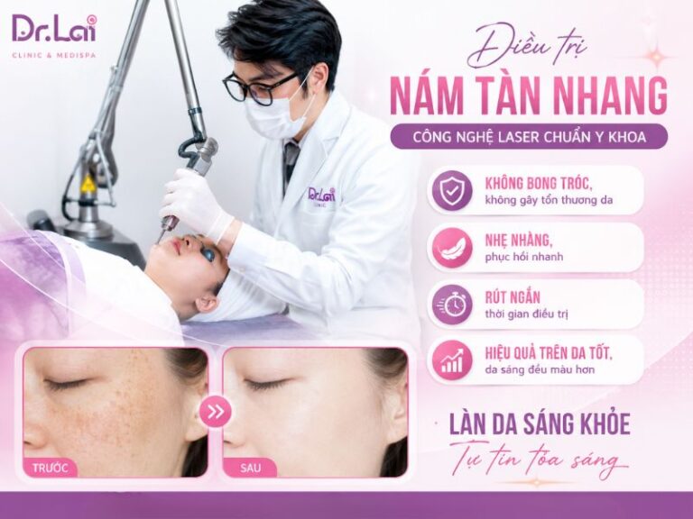 Trị nám tàn nhang bằng laser: Giải pháp cải thiện sắc tố da được nhiều người quan tâm